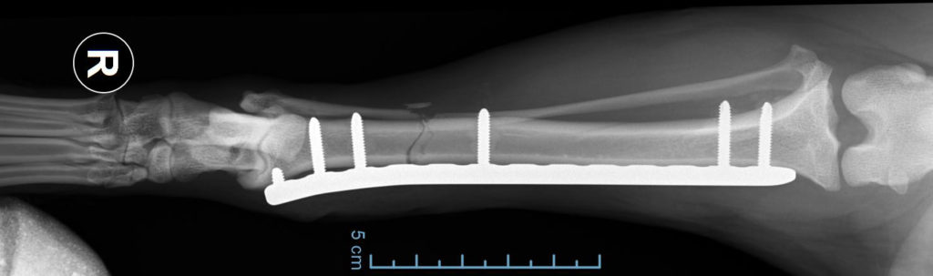 Xray showing plate and screws